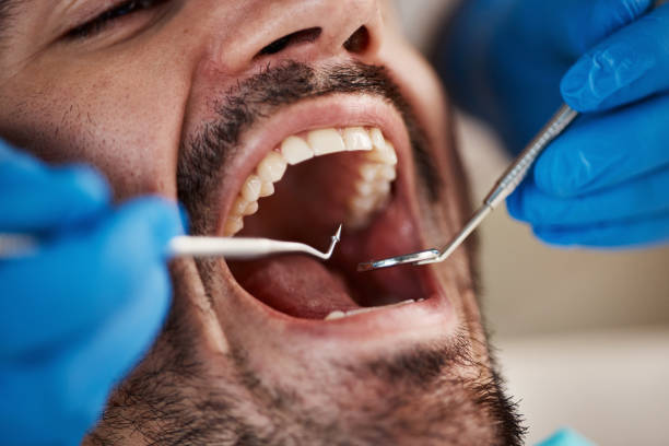 Emergency Dental Services in Columbus, TX