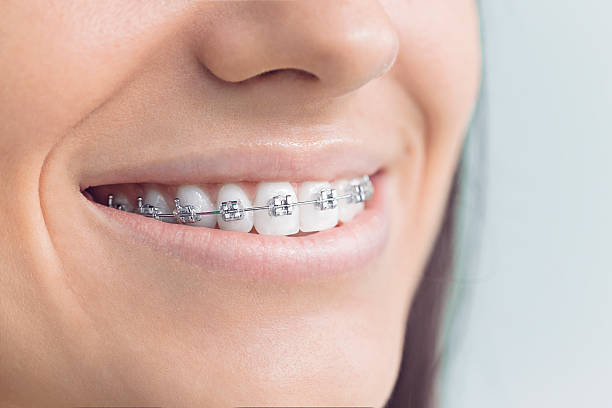 Dental Inlays and Onlays in Columbus, TX